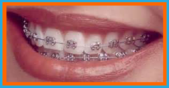 riley-r-swanson-dds-my services-orthodontics-braces